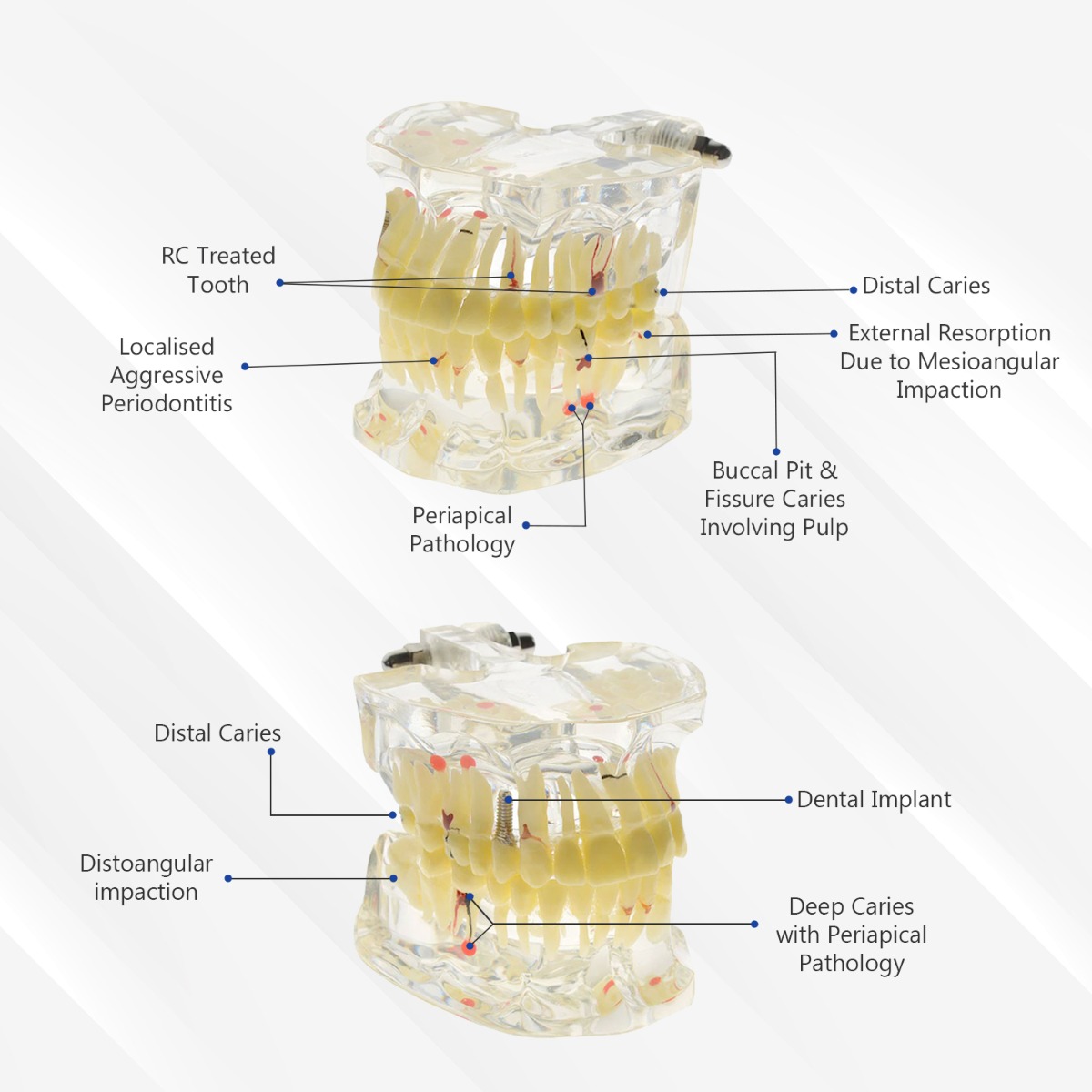 iDENTical Adult Pathologies Model M4001-1