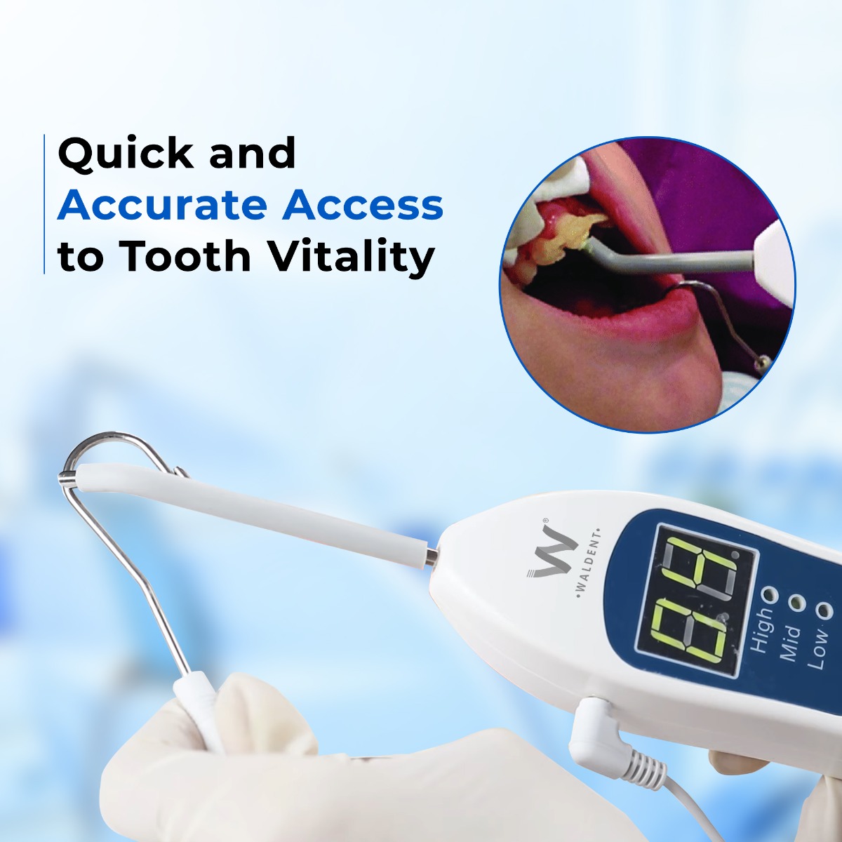 Waldent Electric Pulp Tester