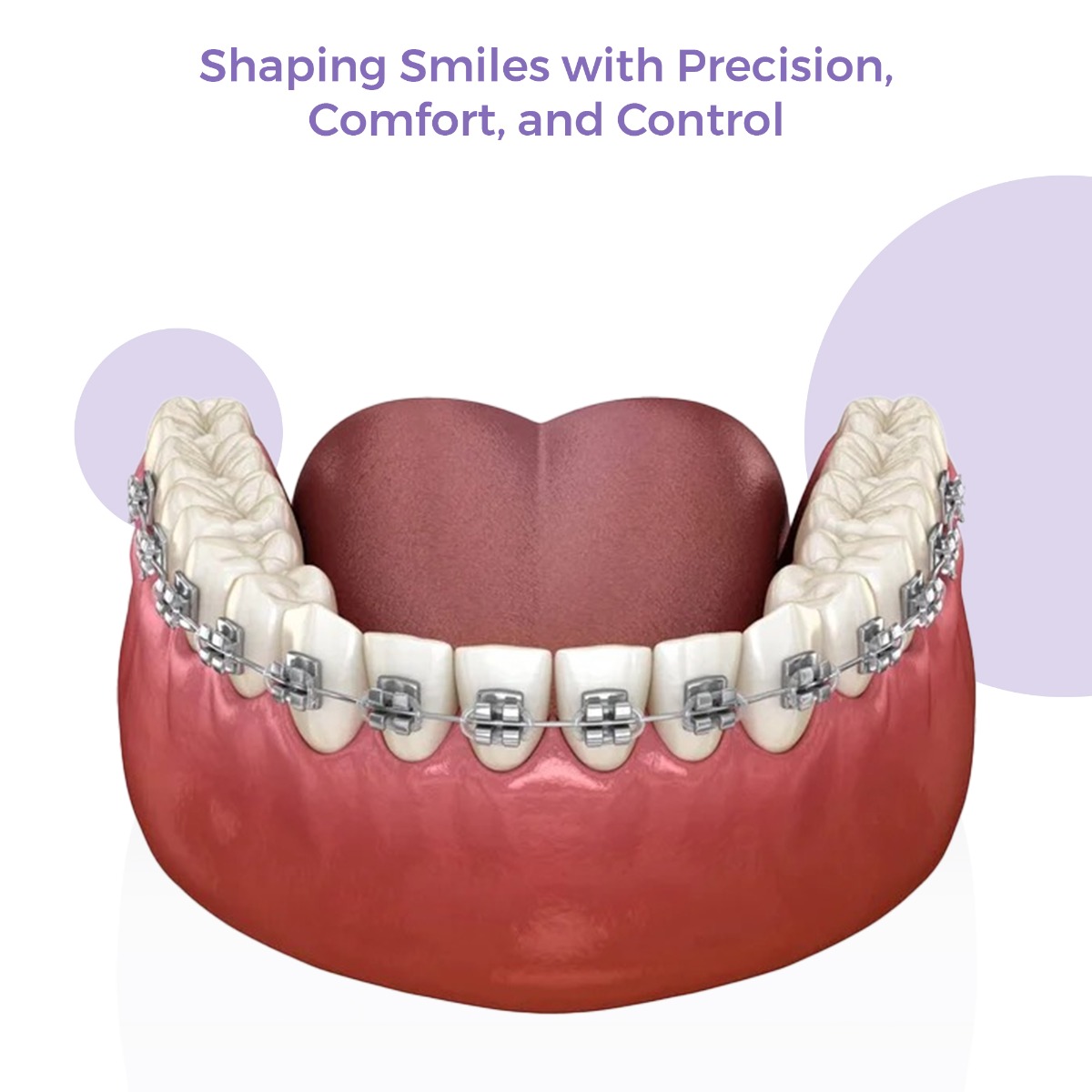 OrthoMetric Flexy NiTi Reverse Curve Intraoral Archwires - Rectangular (10/Pk)