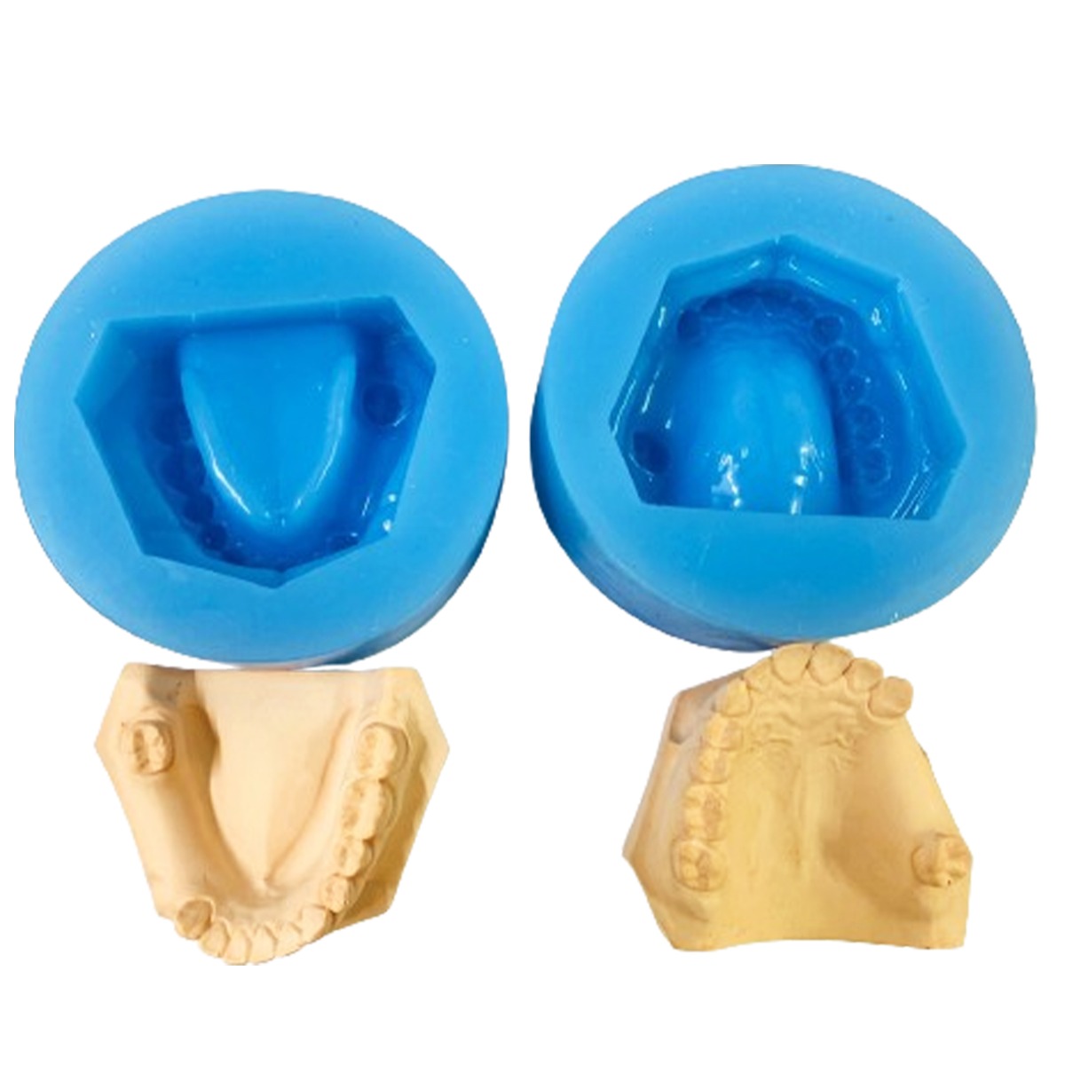 iDENTical Partially Edentulous Silicone Cast Moulds