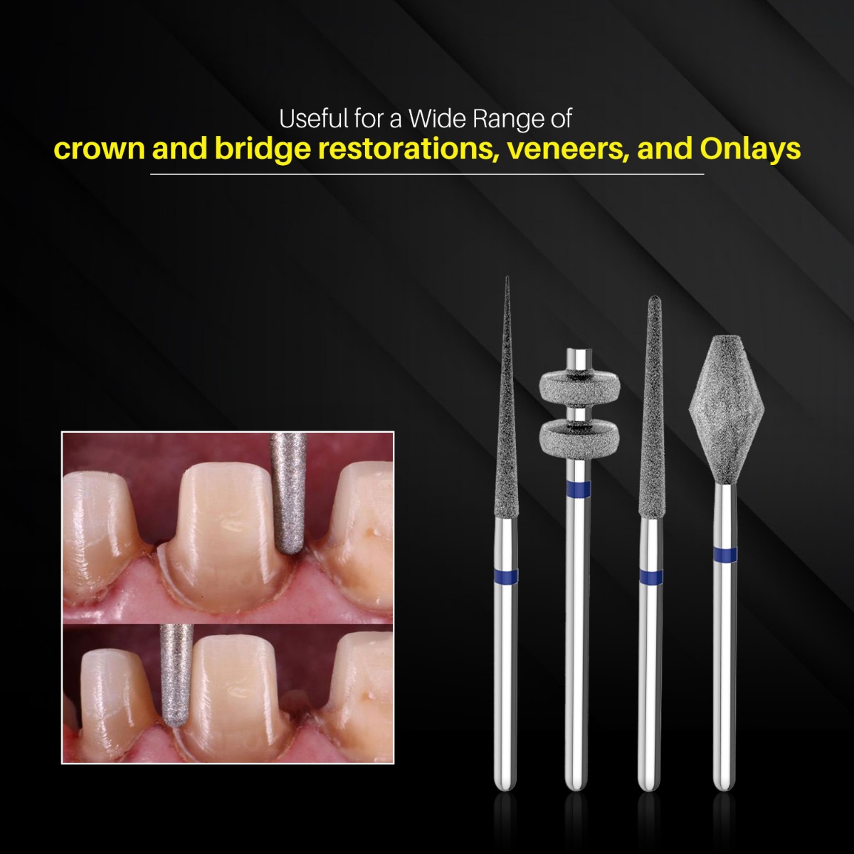 SuperEndo Crown Preparation Bur Kit
