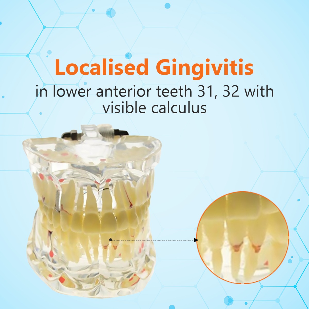 iDENTical Adult Pathologies Model M4001-1