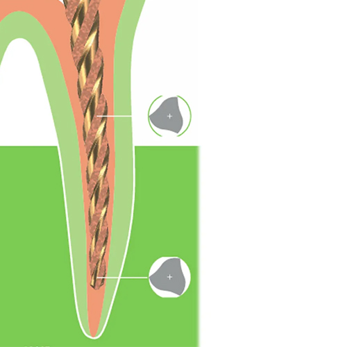 Micro Mega Retreat Retreatment Files 