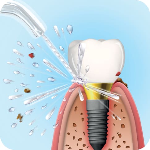 Aquapick Cordless Oral Irrigator AQ-208