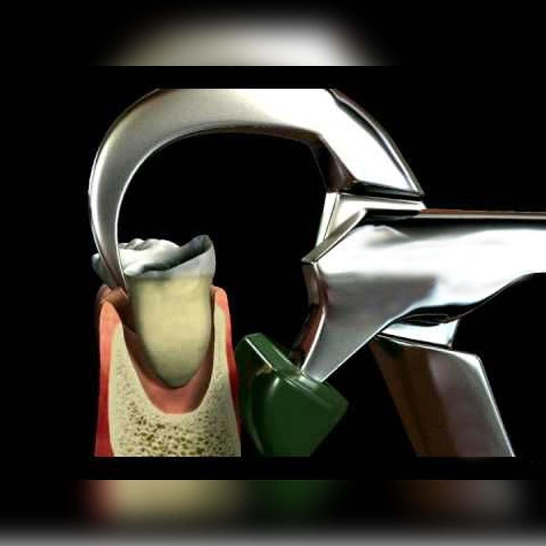 Waldent Physics Forceps - Pack of 1