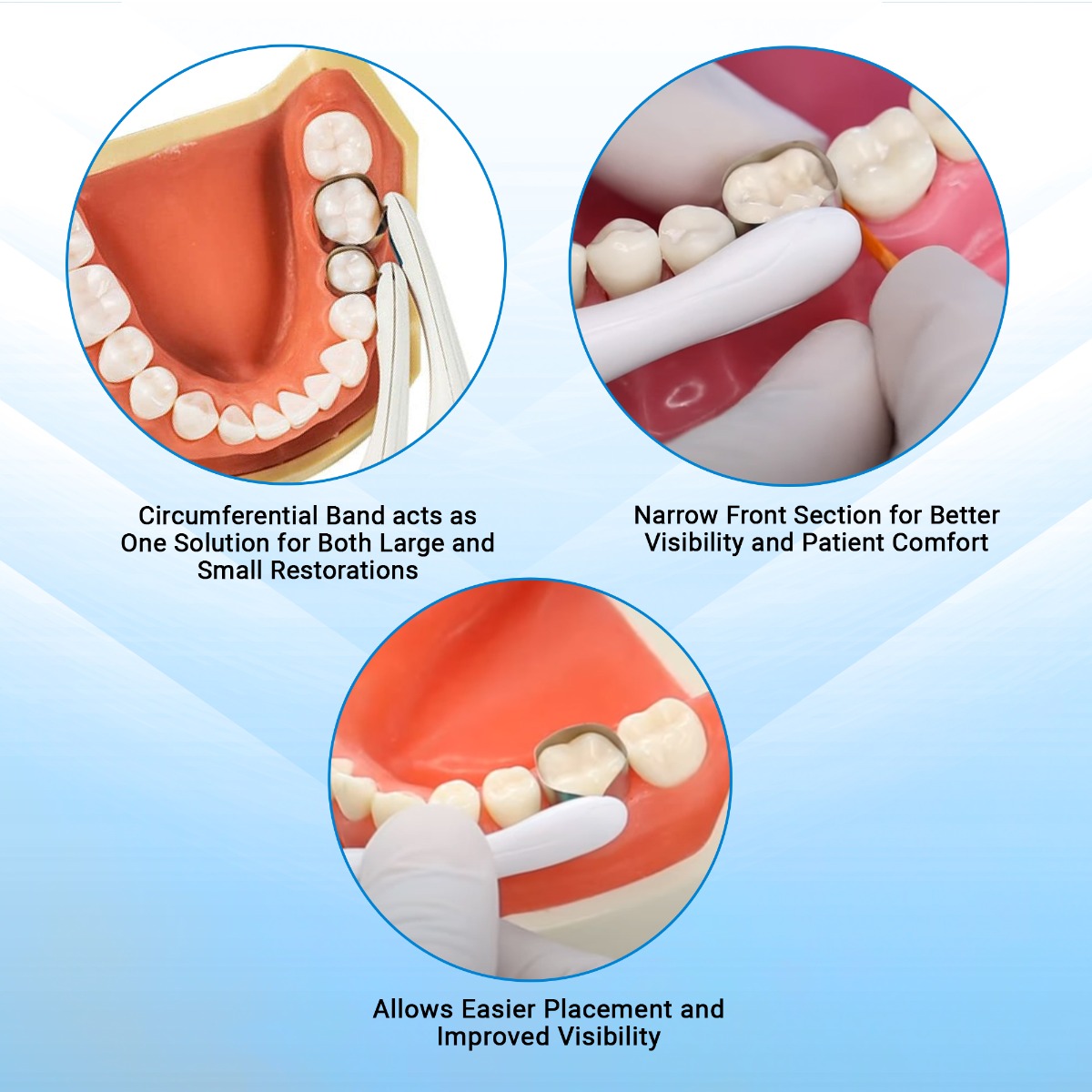 SuperEndo Automatic Matrices (Pack of 10)