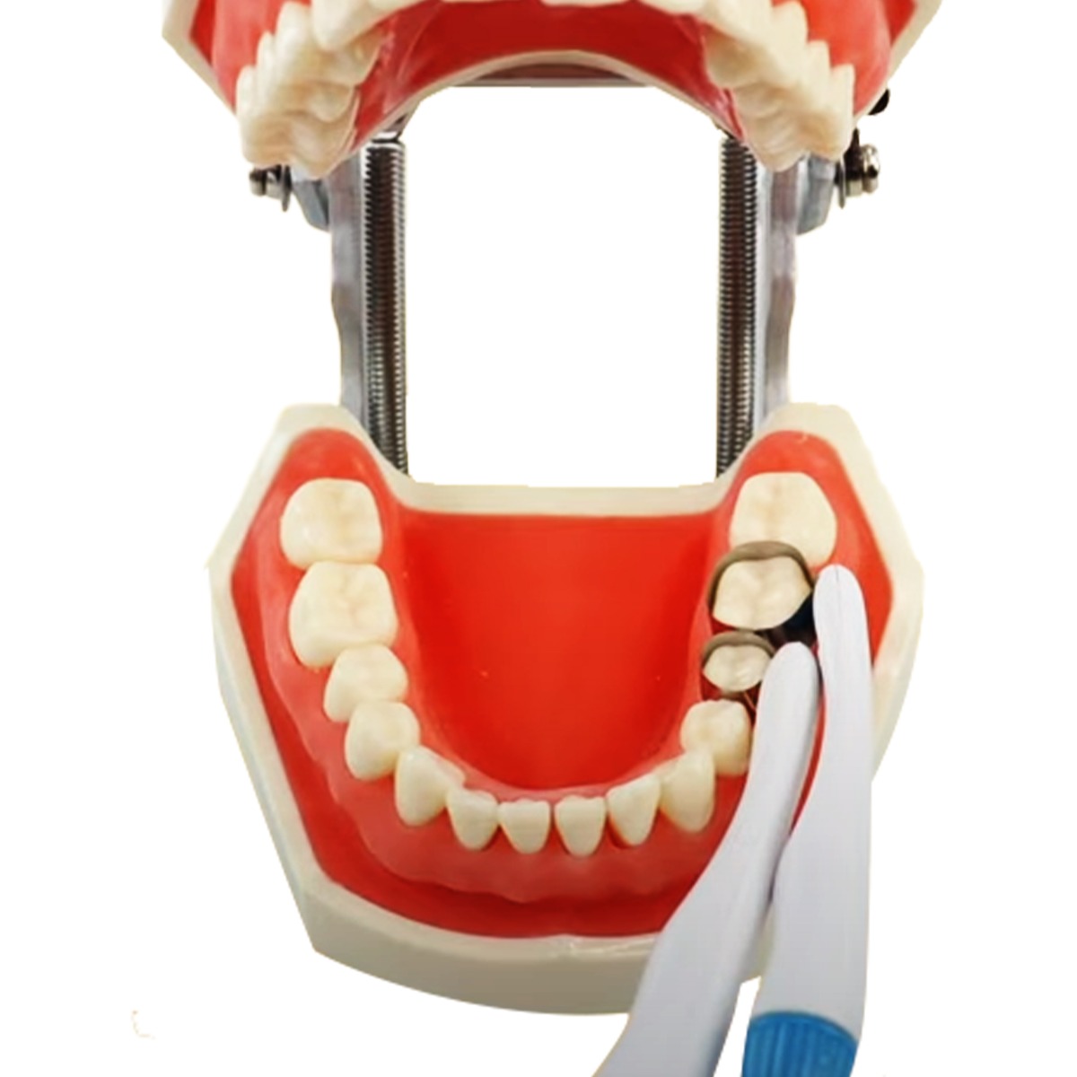 SuperEndo Automatic Matrices 6 mm Curved Wide Band (Green C-6) (Pack of 10)