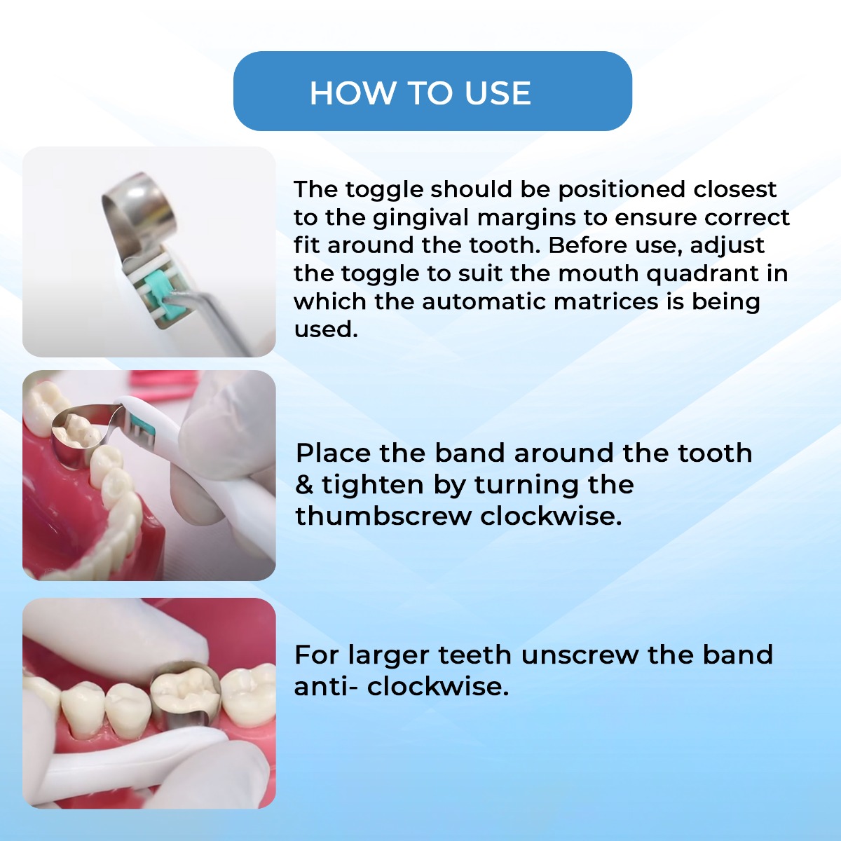 SuperEndo Automatic Matrices 6 mm Curved Wide Band (Green C-6) (Pack of 10)