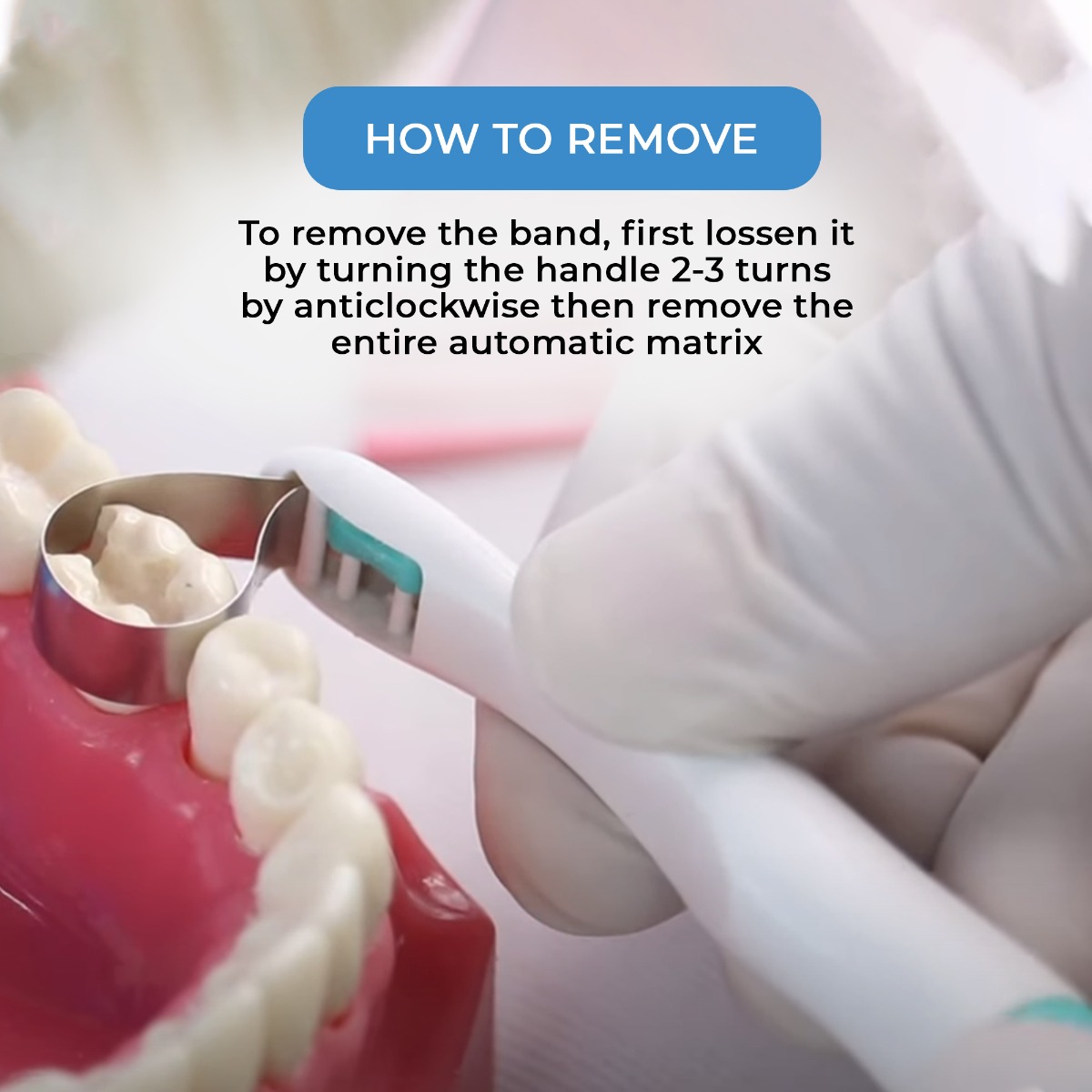 SuperEndo Automatic Matrices 6 mm Curved Wide Band (Green C-6) (Pack of 10)