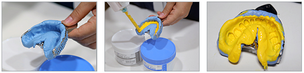 Neosil Peakosil A-Silicone Putty + Light Body Combo Start Kit