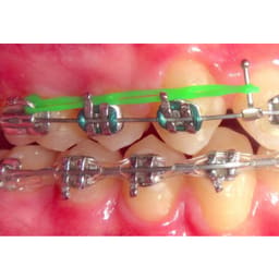 Ortho 