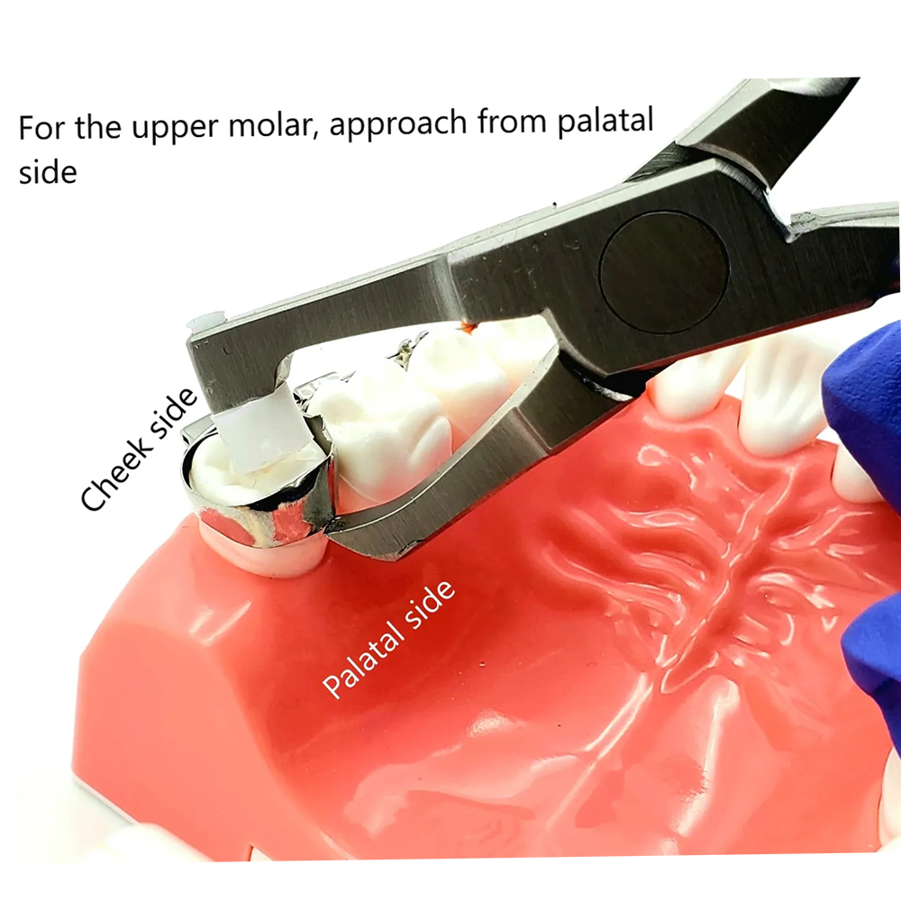 Koden Posterior Band Removing Plier (Euphoria League)