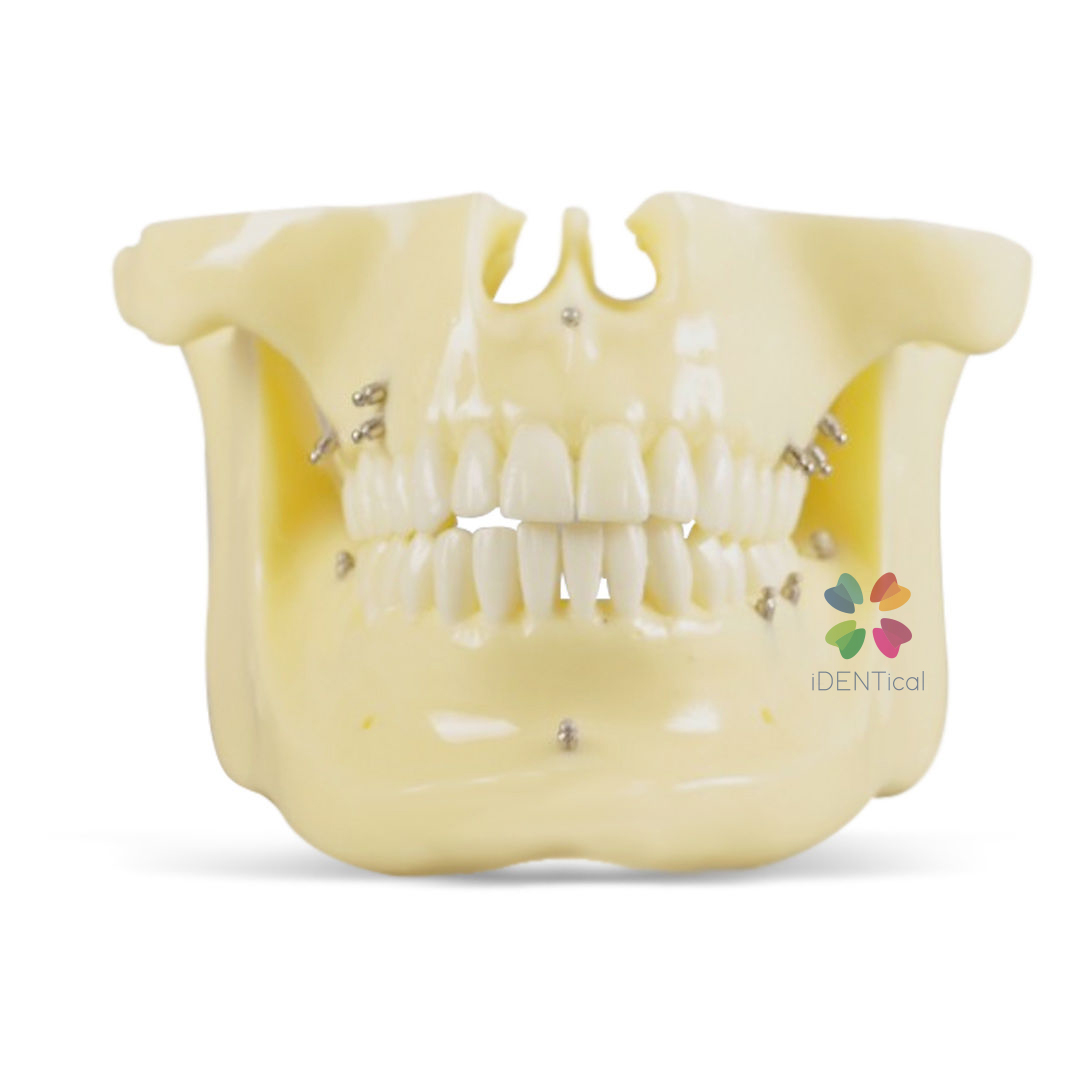 iDENTical Orthodontic Implant Model - M2016