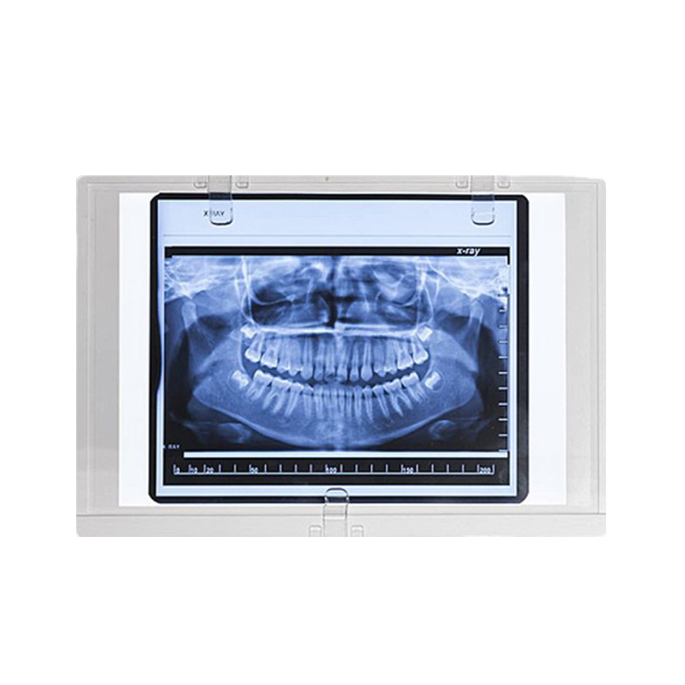 Sparedent Panoramic X-ray Viewer - Chair Mount