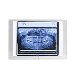 Sparedent Panoramic X-ray Viewer - Chair Mount