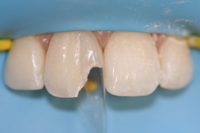 Tor Vm Transparent Striprolls