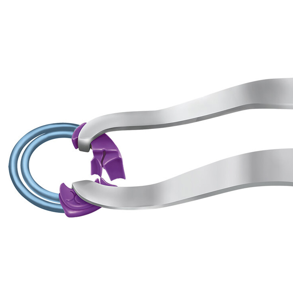 Bioclear TwinRing For Class II Matrix Adaptation