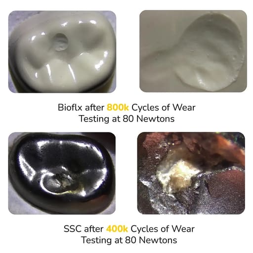 Kids-e-Dental BioFlx Upper Left 2nd Molar Crowns Refills