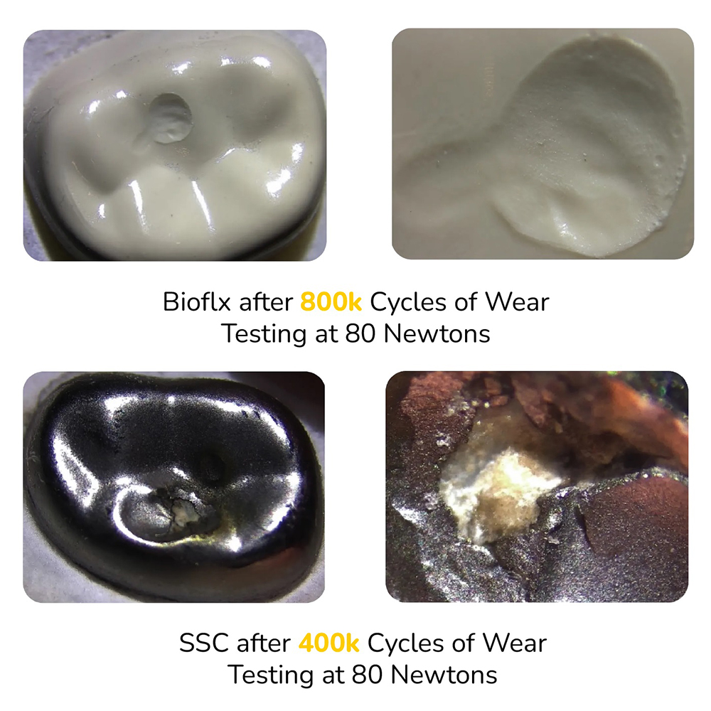 Kids-e-Dental Bioflx Posterior Crown Kits