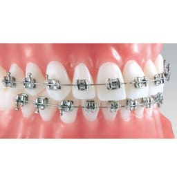 ET Dental MBT 022 Mini Brackets Kit (Non-Extraction) - 9
