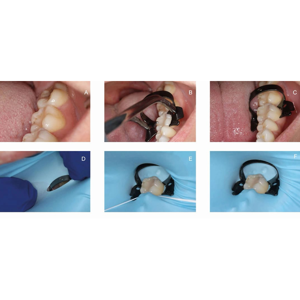 GDC Rubber Dam Clamps Set # Black (RDCOBB11)