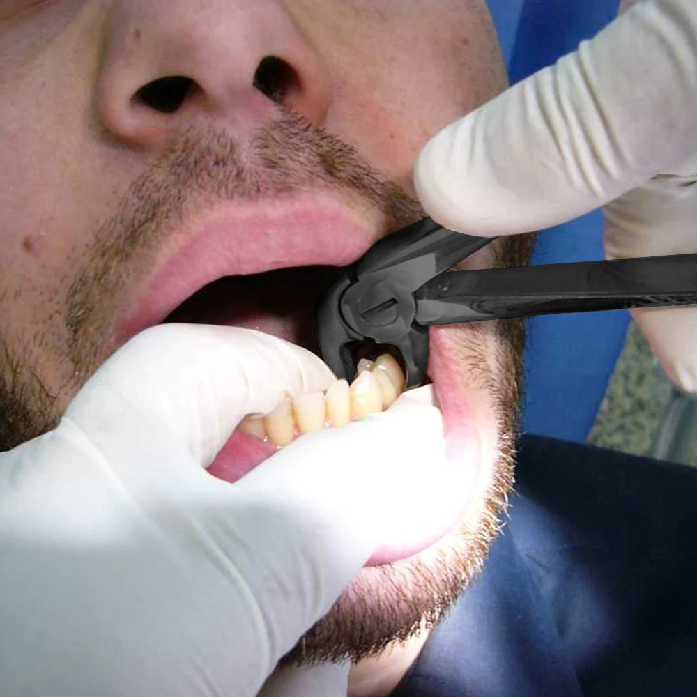 GDC Black Plasma Coated Extraction Forcep Kit