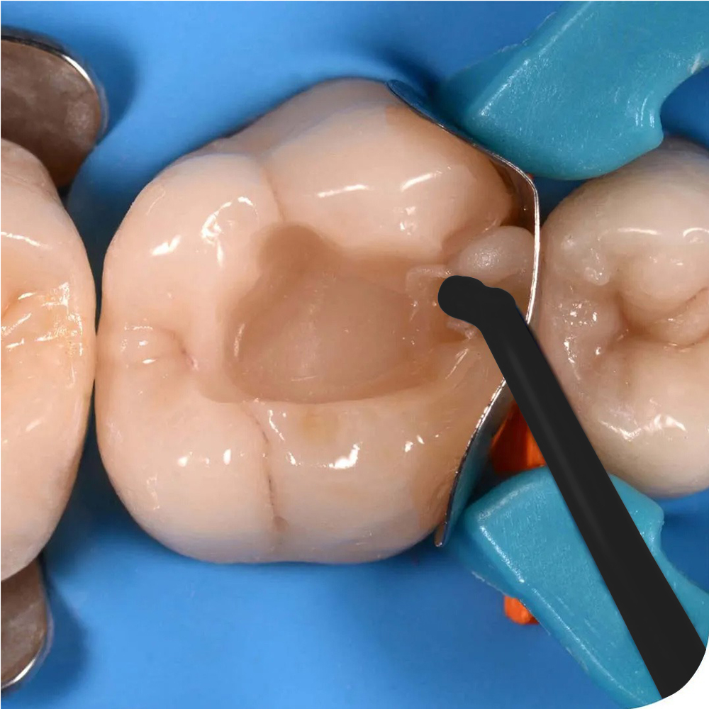 GDC Teflon Coated Composite Instrument Posterior Set Of 5 Pcs (CIPP5)