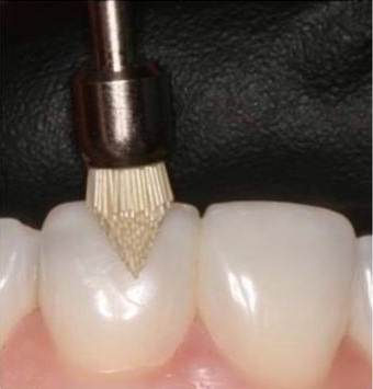 Waldent Nitrile Examination Gloves- Black (Pack of 80)