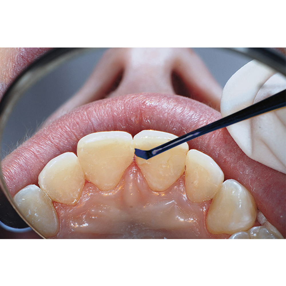 GDC Composite Instrument Blue Titanium - 6 (CIB1)