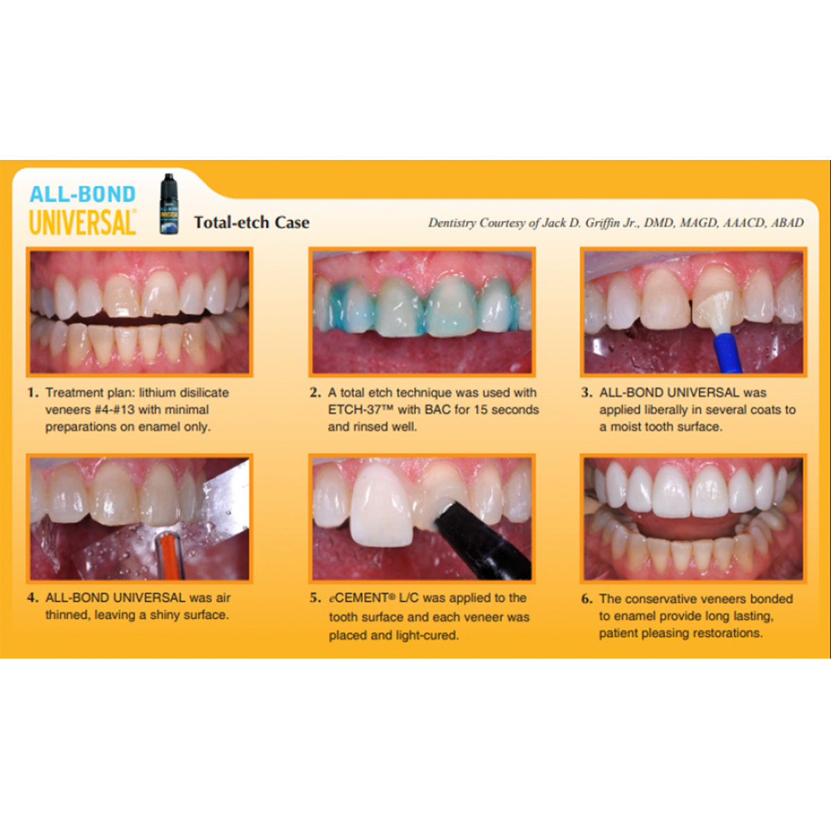 Bisco All Bond Universal LC Adhesive 4ml