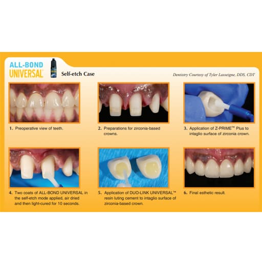 Bisco All Bond Universal LC Adhesive 4ml