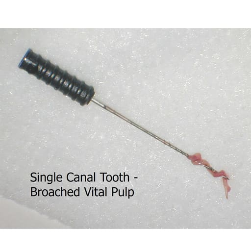 Waldent Barbed Broaches 25mm (Pack of 6)