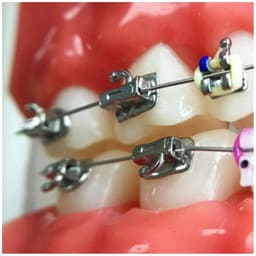 Koden 1st Molar Bondable Buccal Tubes (Pack of 4) - 8