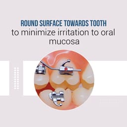 UU Ortho Premium Bondable Buccal Tubes MBT (Pack of 20 Sets) - 25