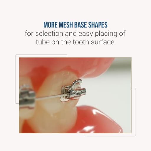 UU Ortho Premium Bondable Buccal Tubes MBT (Pack of 20 Sets)
