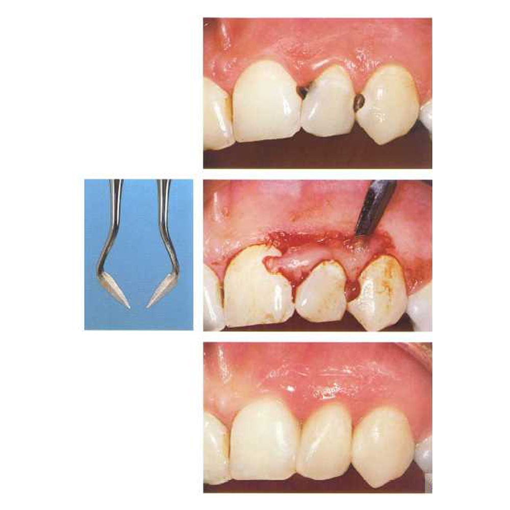 GDC Buck Knife #6 (Kb5/6)