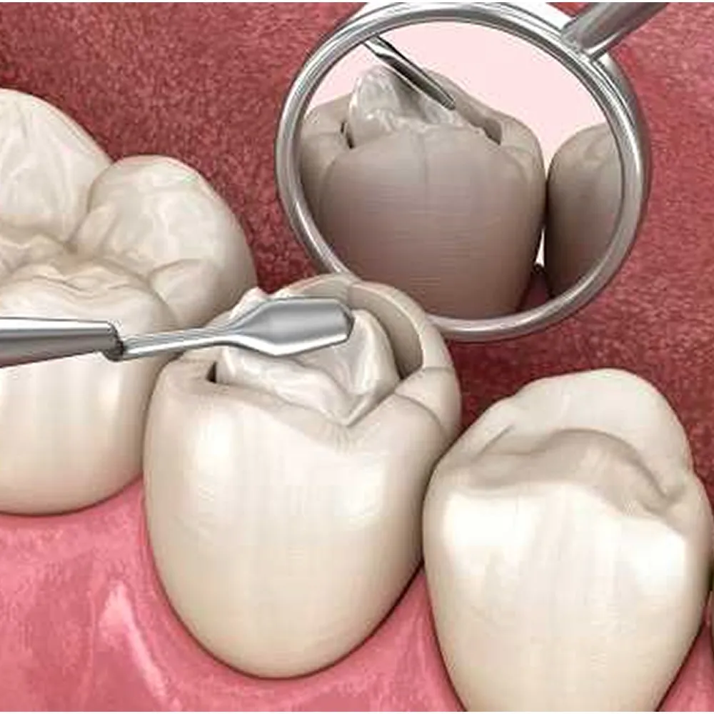 GI Dental Parallelogram Condenser