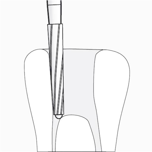 SuperEndo Endo-Z Tungsten Carbide Burs