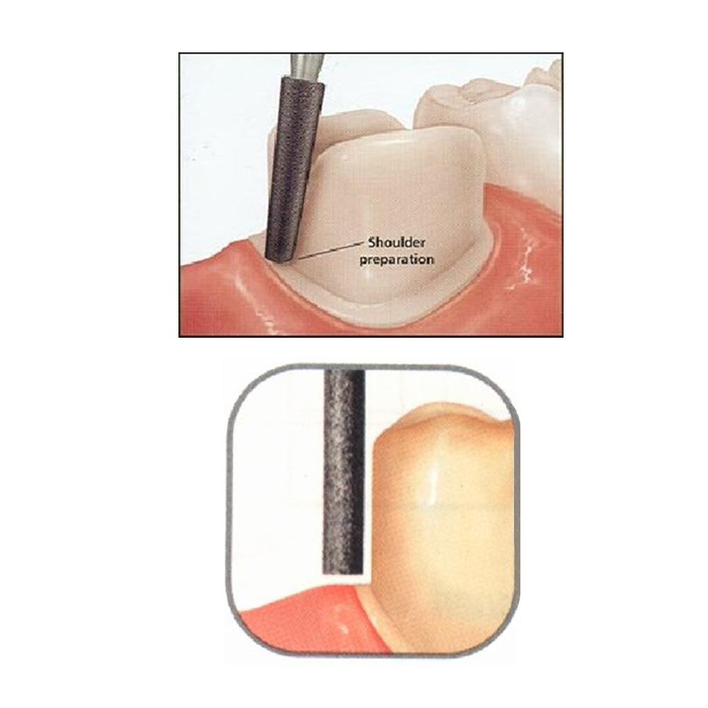 SuperEndo Shoulder Preparation Burs Kit