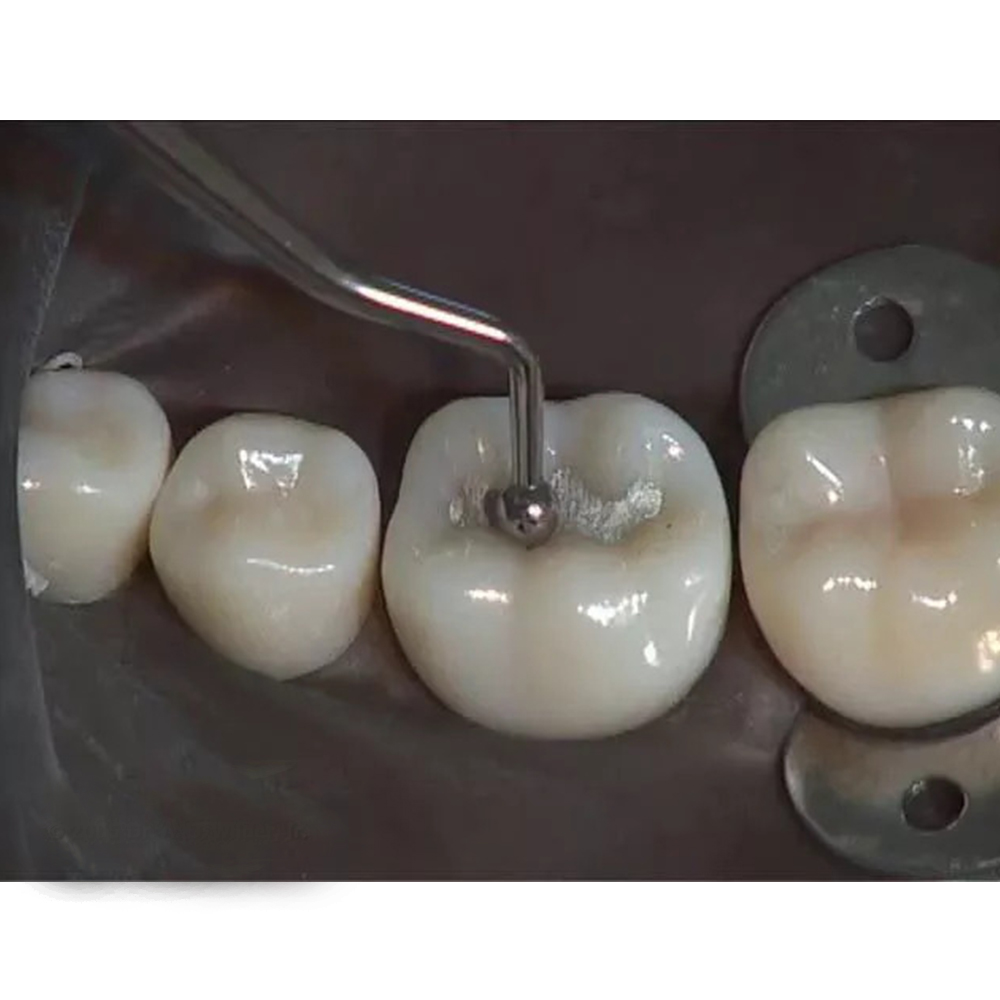 GDC Ball Burnisher - 3 (Bb22/23)