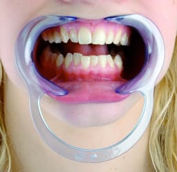 Cotisen Cheek Retractor - 15