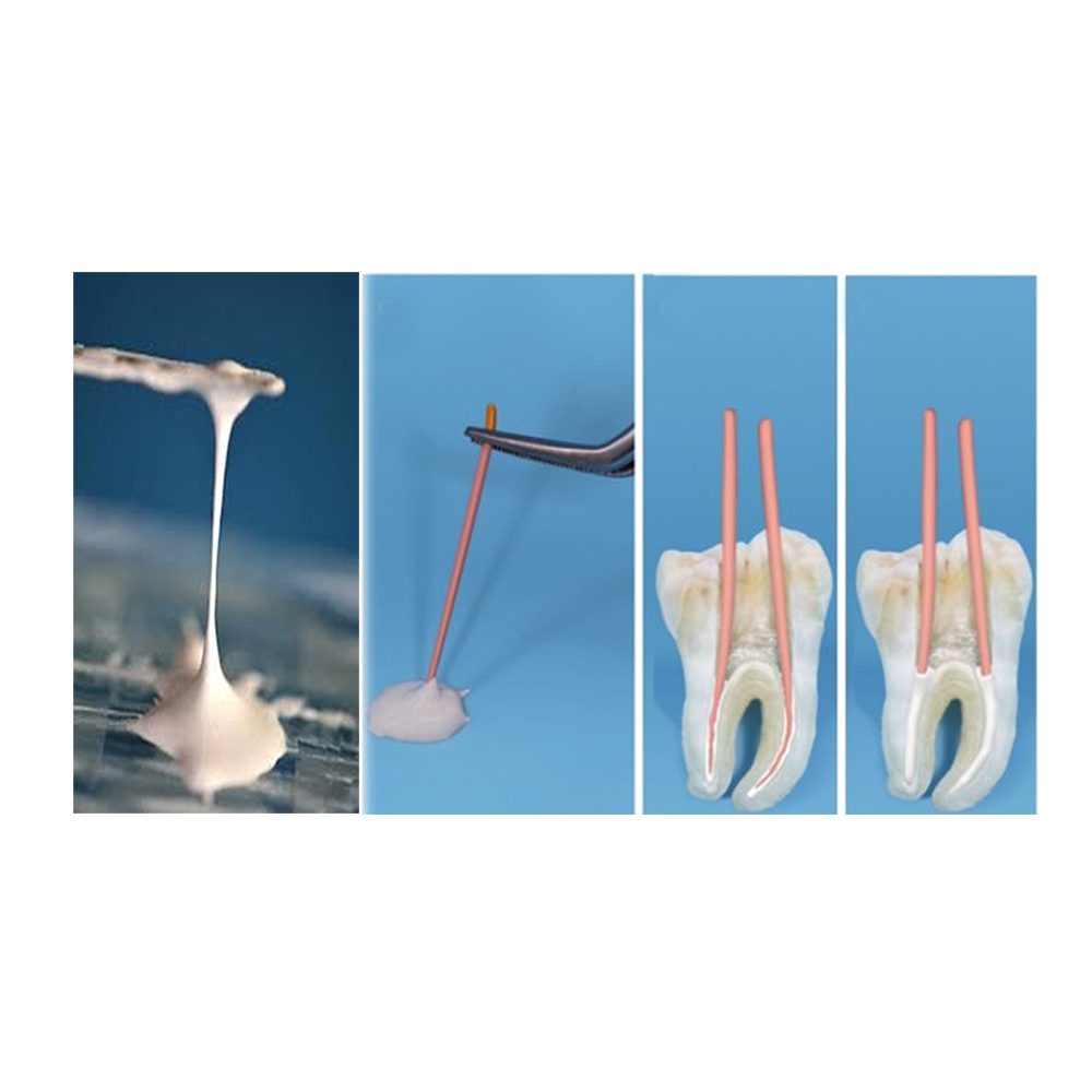 Prime Dental Rc Seal Plus