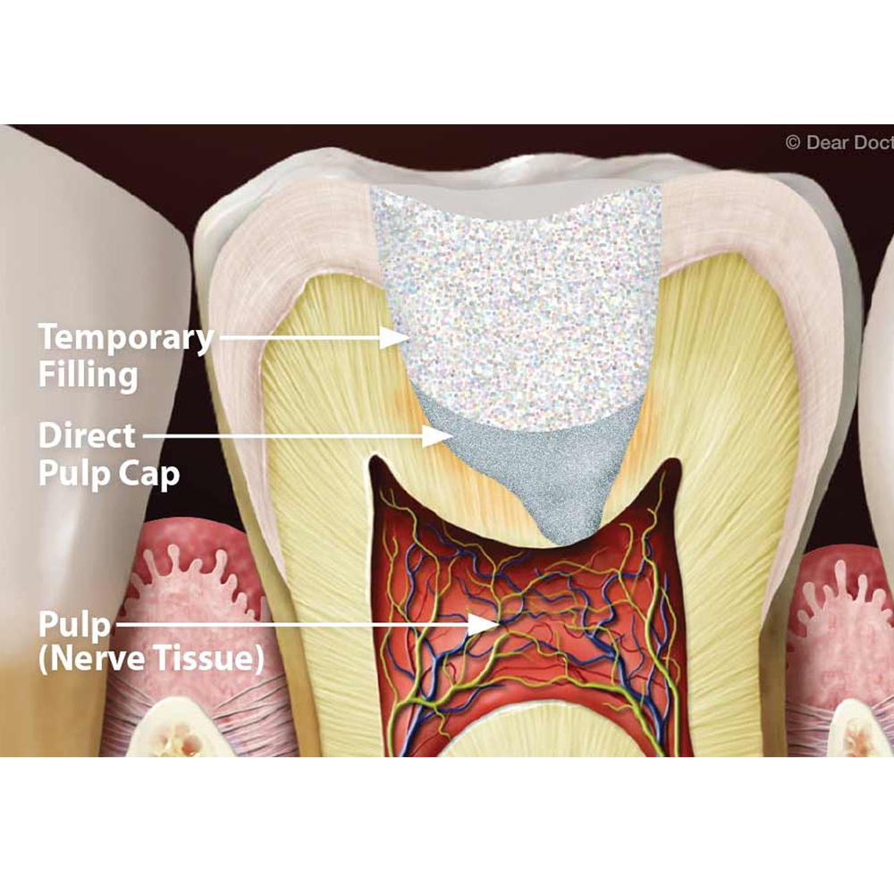 Prime Dental Temporary Filling Calcium Hydroxide Powder 10g Bottle