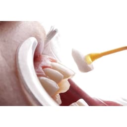 Dentsply Calibra Base Refills - 3
