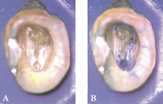 Cerkamed Canal Detector 2ml