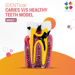 iDENTical Caries V/S Healthy Teeth Model M4021 - 19