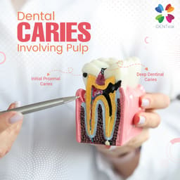 iDENTical Caries V/S Healthy Teeth Model M4021 - 17