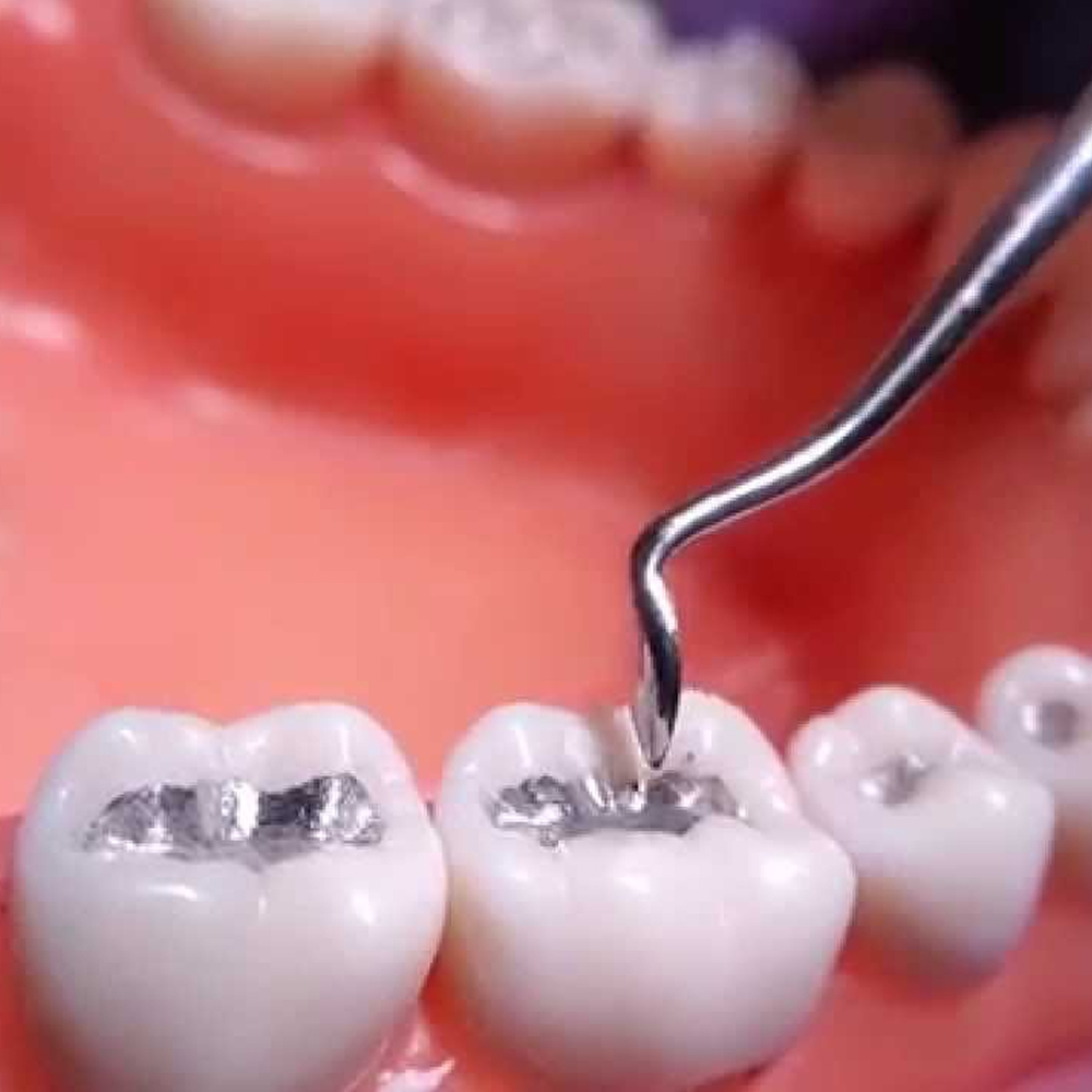 GDC Carver Hollenback - 4 (CVHL3S)