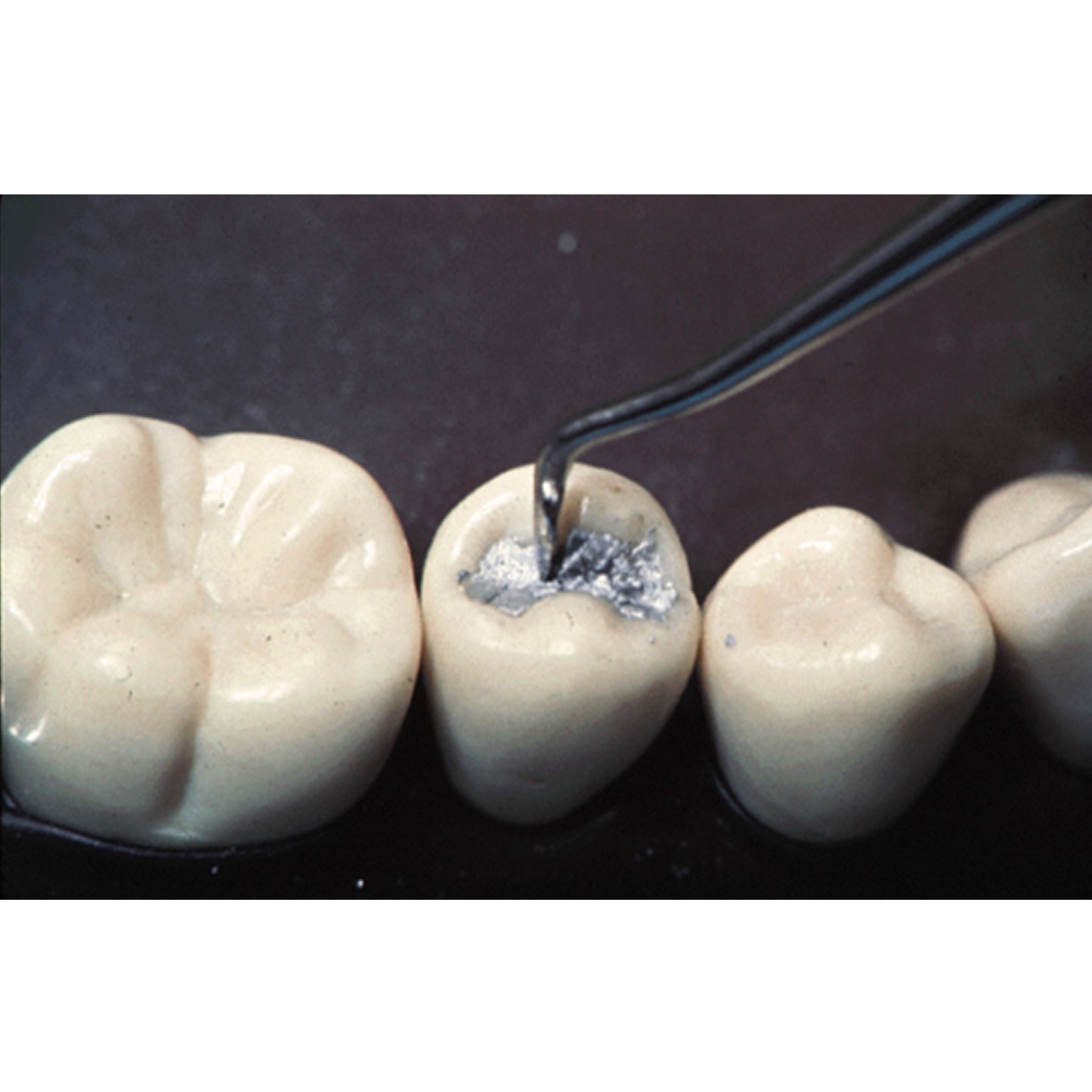 GDC Carver Hollenback - 4 (CVHL3S)