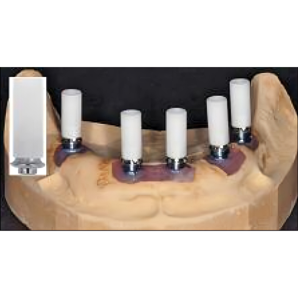 Adin NP Engaging Plastic Cylinder Casting Abutment 3.7mm x GH 0.7mm x 11mm (NP0045)